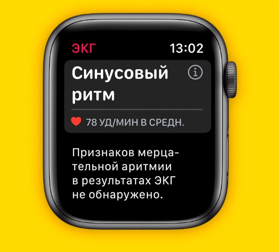 ЭКГ